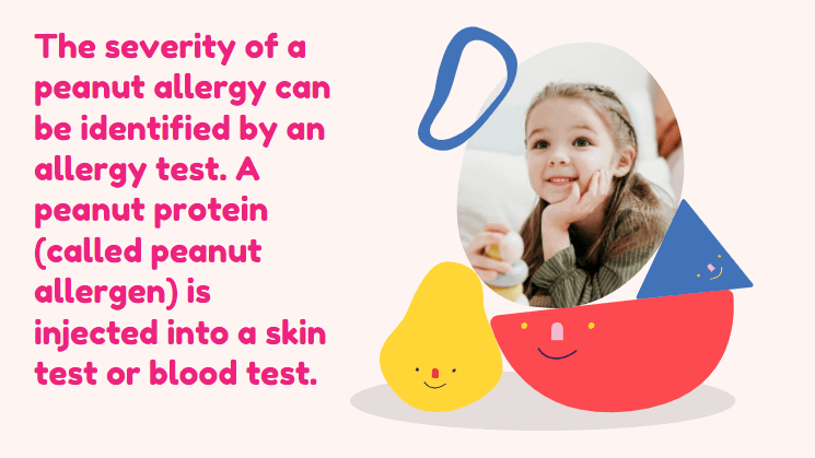 baby peanut allergy reaction