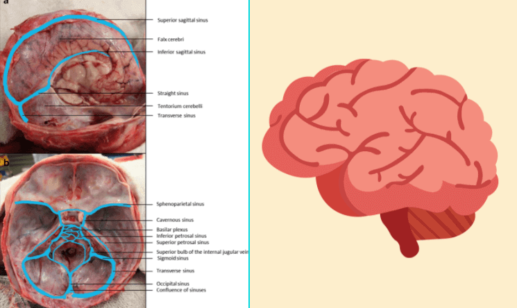 Venous Sinuses of Brain