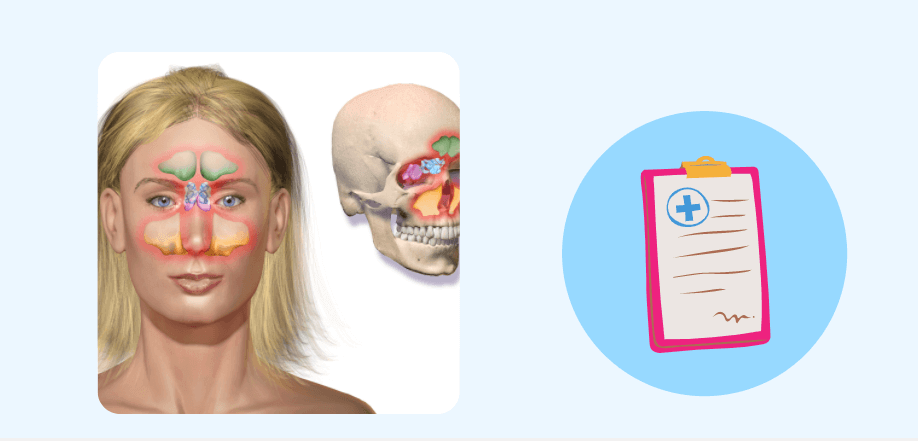 chronic sinusitis ct scan