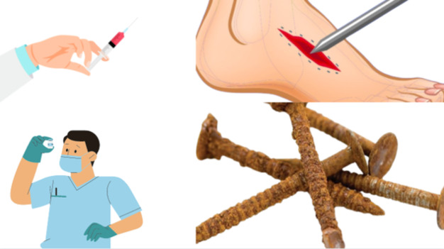 do you get tetanus from rust
