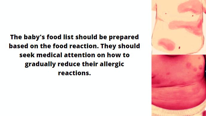 food allergy in baby rash