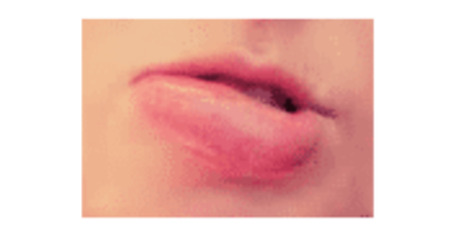 swollen lips allergy food