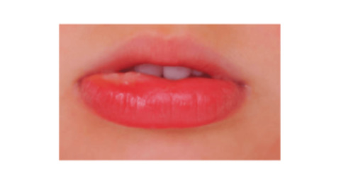 swollen lips allergy food