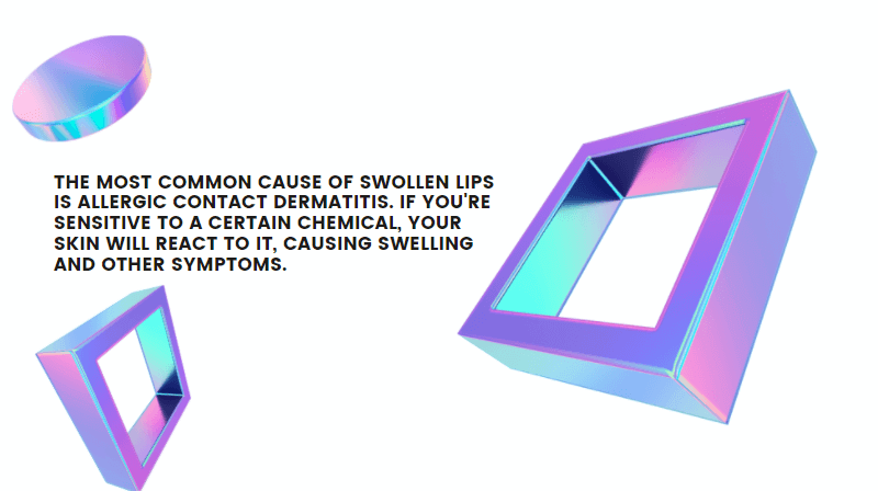 swollen lips allergy food