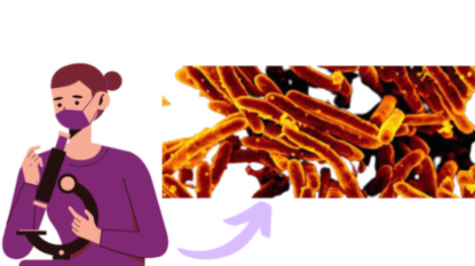 treatment for latent tuberculosis