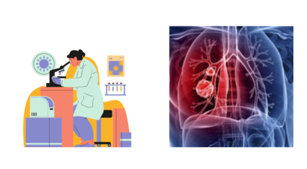 what is the 2 step tb test