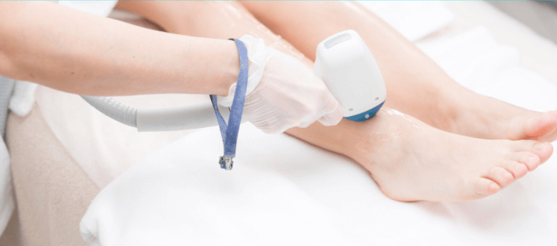 laser hair removal cost in USA