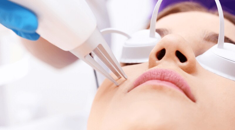 laser hair removal cost in USA