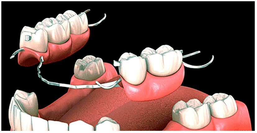 professional denture clinic near me