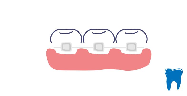 professional denture clinic near me