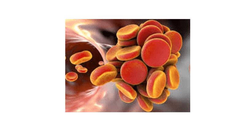 treatment for blood clot in brain