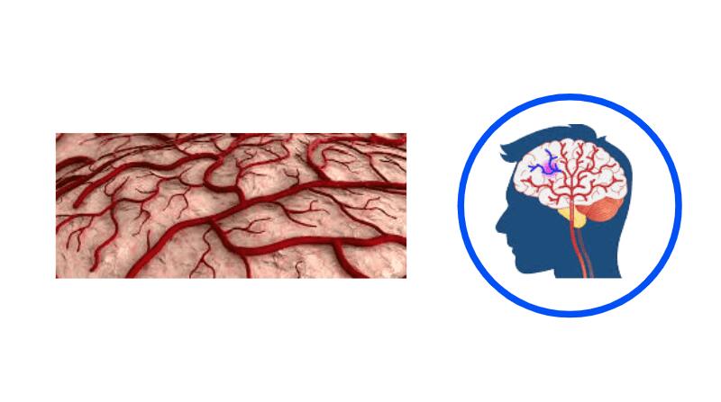 treatment for blood clot in brain