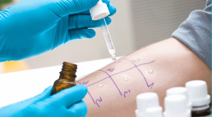 allergy tests near me