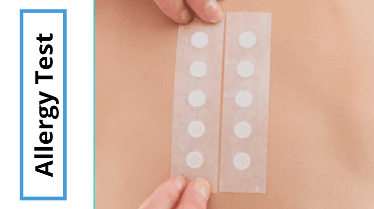 allergy tests near me
