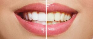 best dental clinic in Australia