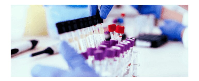 Drug Test and Pre-employment Criteria