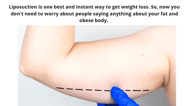 benefits of liposuction