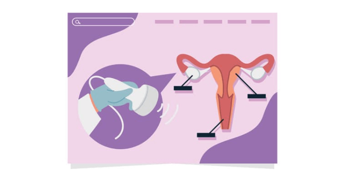 what is gynecology