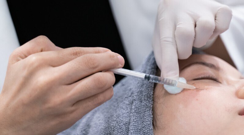 botox fillers