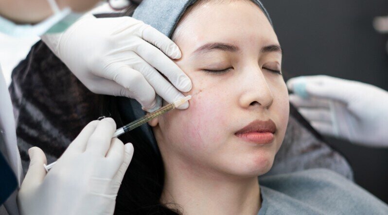 botox fillers