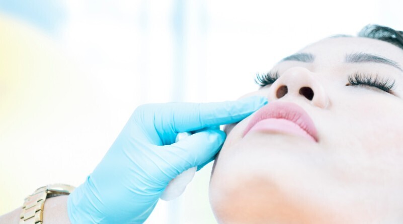 botox fillers