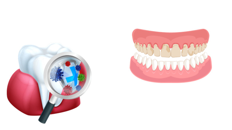 gum disease