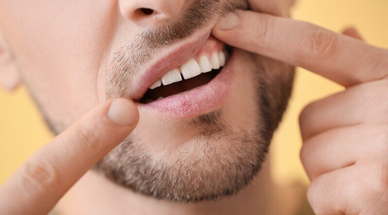 gum disease