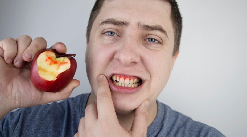 gum disease