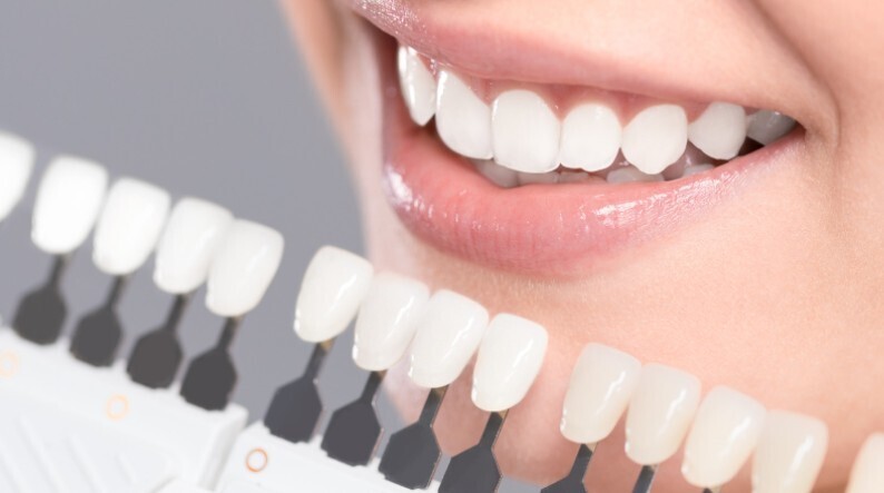 dental implants