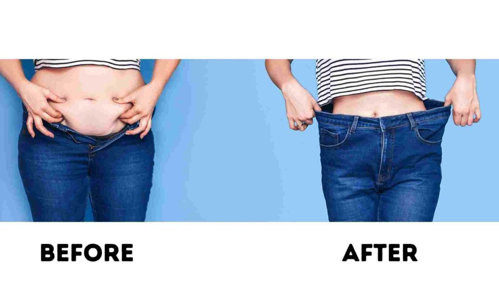 CoolSculpting before and after