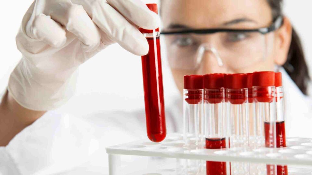 Blood Sample