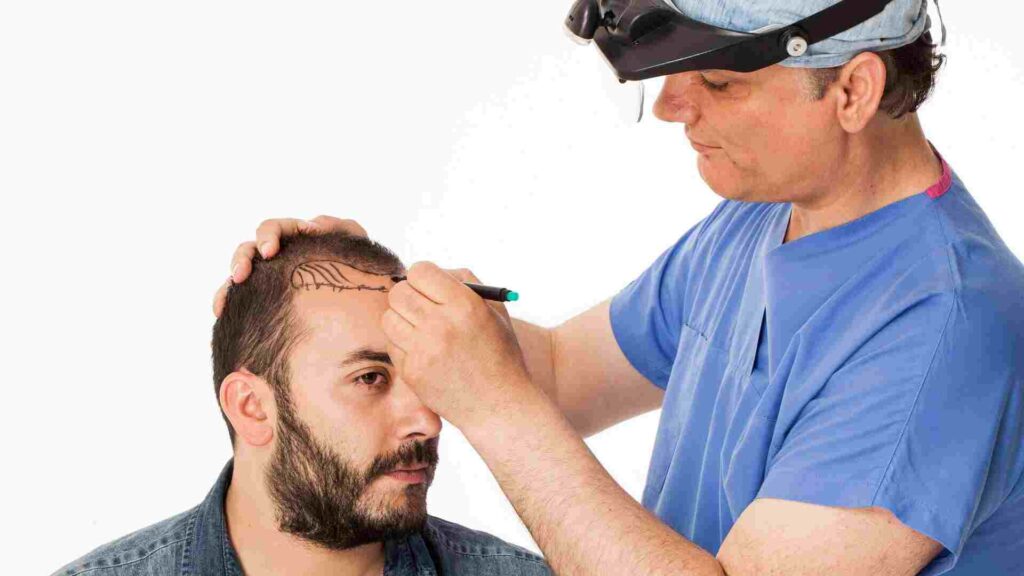 Custom Hair Replacement Systems
